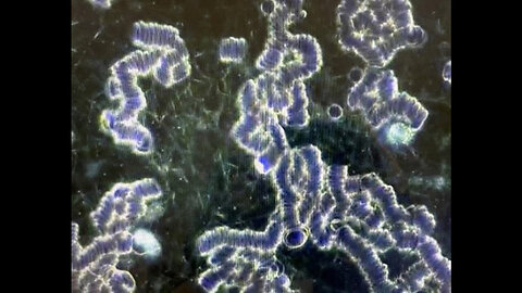 "Post-Vaccine Clots: Shocking Lab Results Unveil Devastating Impact on Millions"