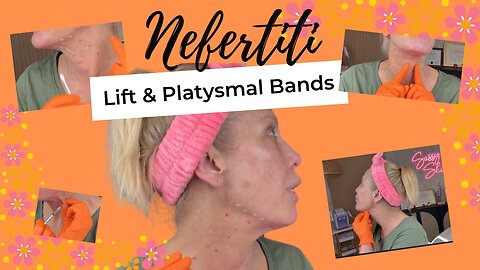 Lower Face Lift Without Surgery: Nefertiti Lift + Platysmal Bands