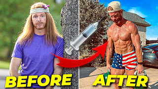 My 5 Year TRT Transformation (What All Men Should Know)