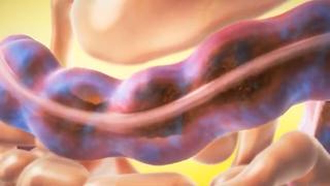 Easy Digestive Problems Fix (Works For Anyone)