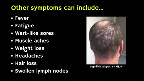Doctor explains the Symptoms and Stages of SYPHILIS (STI)