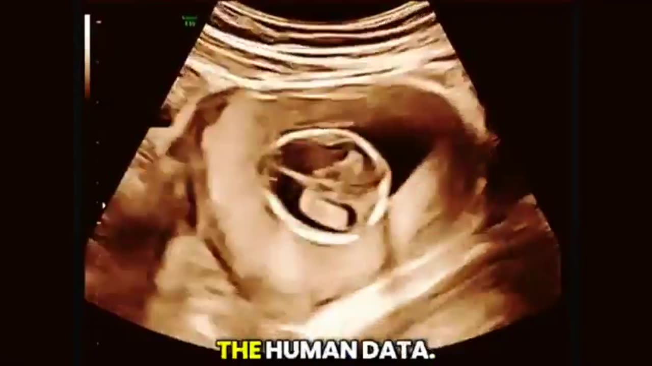 Dr Hulscher, MPH： COVID-19 mRNA shots have devastated the reproductive capacity of humanity