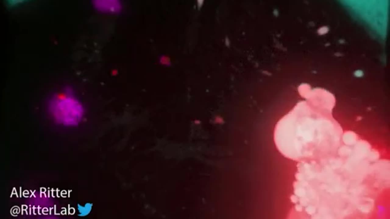 Watch a killer T cell of the immune system destroying a monstrous ovarian cancer cell