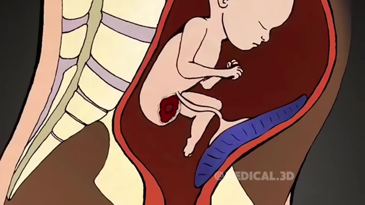 What Happens During An Abbortion (3D Animation)
