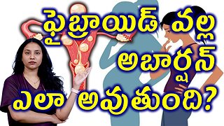 ఫైబ్రాయిడ్స్ వల్ల అబార్షన్ ఎలా అవుతుంది?Body Changes in Infertility Due to Fibroids Homeopathy Cure
