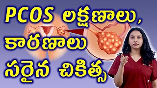 PCOS లక్షణాలు కారణాలు సరైన చికిత్స PCOS Signs, Causes and Best Natural Treatment Cure Medicine