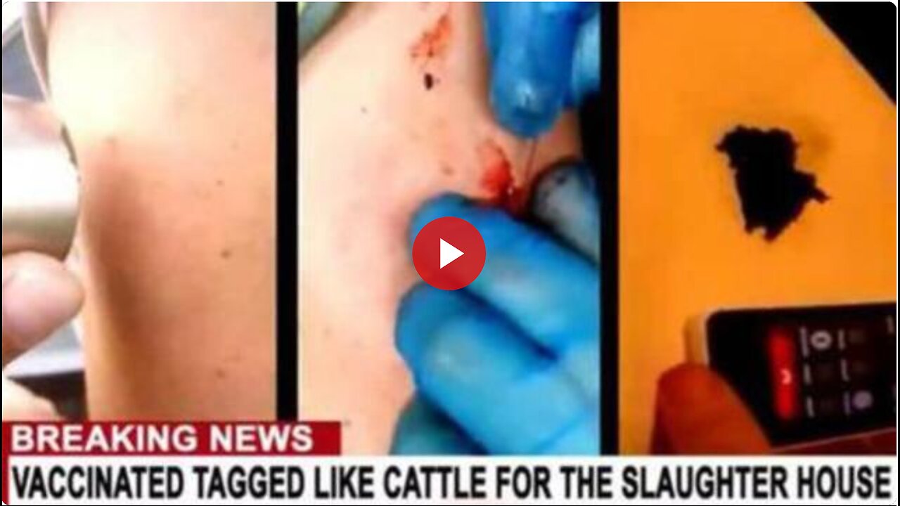 Vaccinated tagged like cattle for the slaughter house- object removed from mans vaccination site
