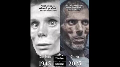 British Doctor: Israel Is Blowing Apart 5-Year-Olds in Gaza — This Isn’t a War, It’s a Massacre