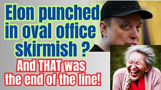 Elon's black eye.... it was not his 5 year old son!