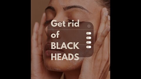 how to get rid of BLACKHEADS