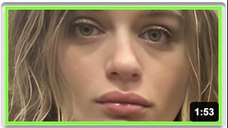 VAX POISONED ACTRESS ALLERGIC TO EVERYTHING