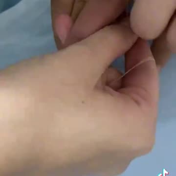 Como tirar anel do dedo