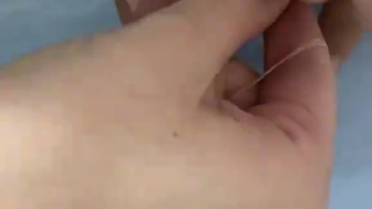 Como tirar anel do dedo