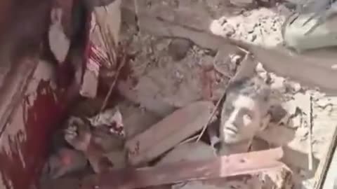 Horrific images document the massacre committed by the Israeli occupation (Graphic)