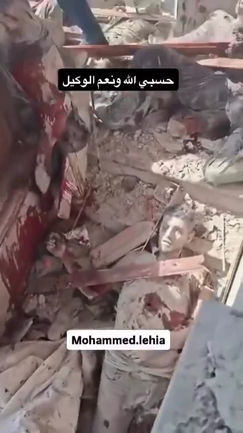 Horrific images document the massacre committed by the Israeli occupation (Graphic)