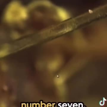 They Are Not Blood Clots✨🙌🏾💫