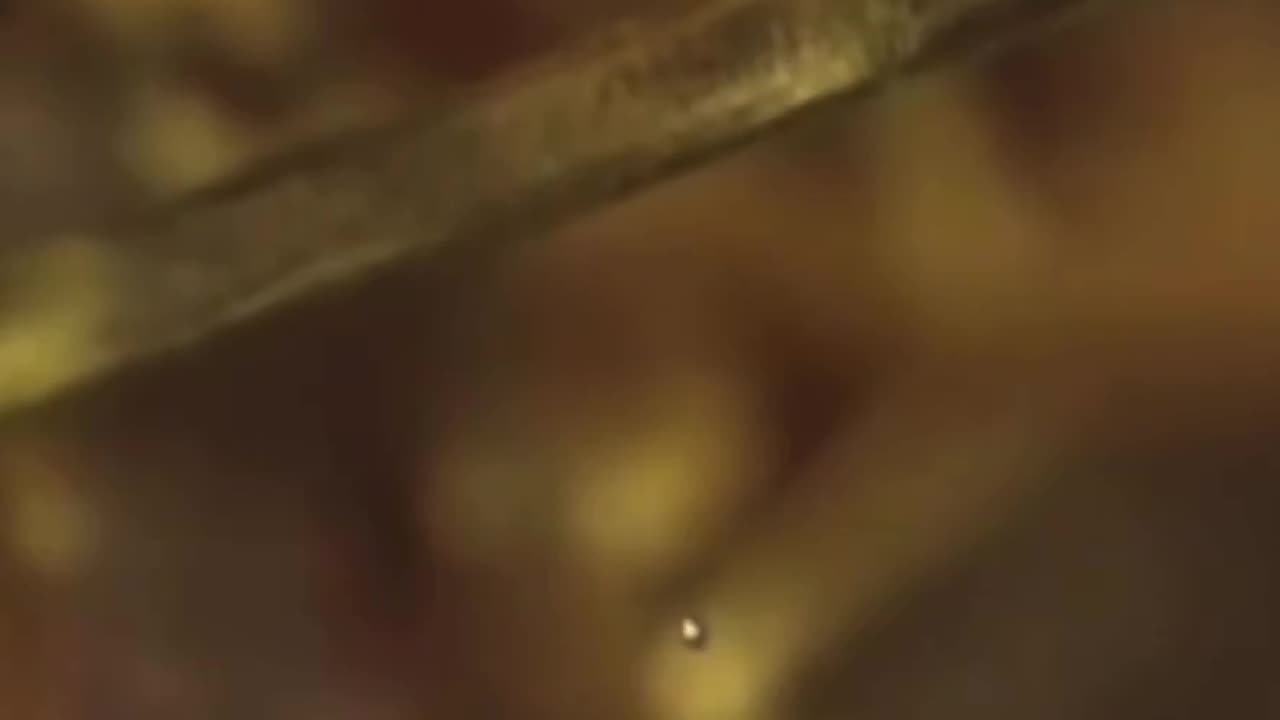 They Are Not Blood Clots✨🙌🏾💫