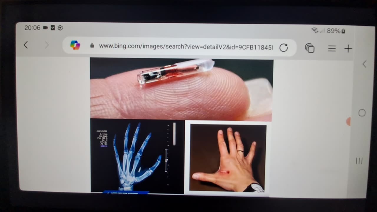 RFID UPDATES CHIP APPROVALS FDA-GMSUKTHEENDISNIGH2
