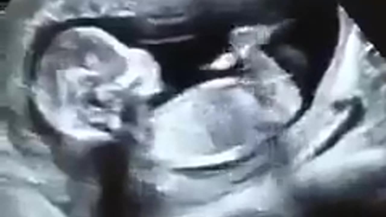 “Before I formed you in the womb I knew you” Jeremiah 1:5