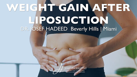 What happens if I gain weight after liposuction?