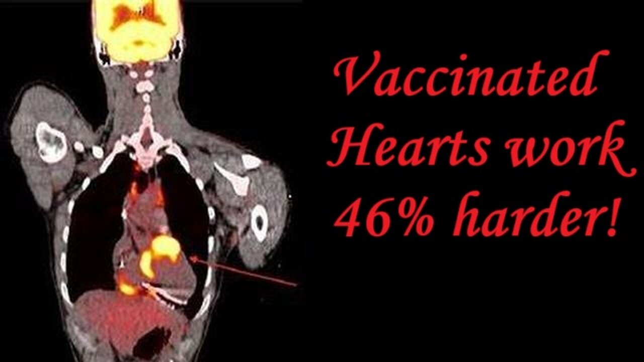Vaxxed Hearts work 46% HARDER!