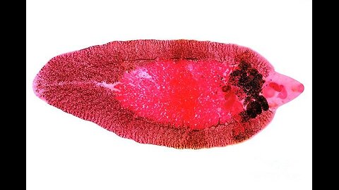 Human Parasites - Liver Fluke | Symptoms | Treatment