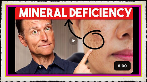 The #1 Deficiency behind Aging Spots