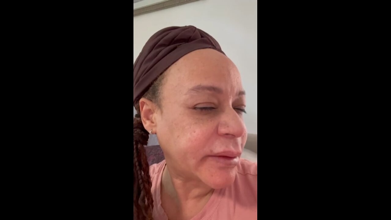 DIY next days of filler dissolver in face!