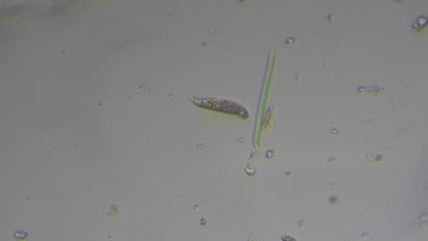Amoeba from Outdoor Dirty Water