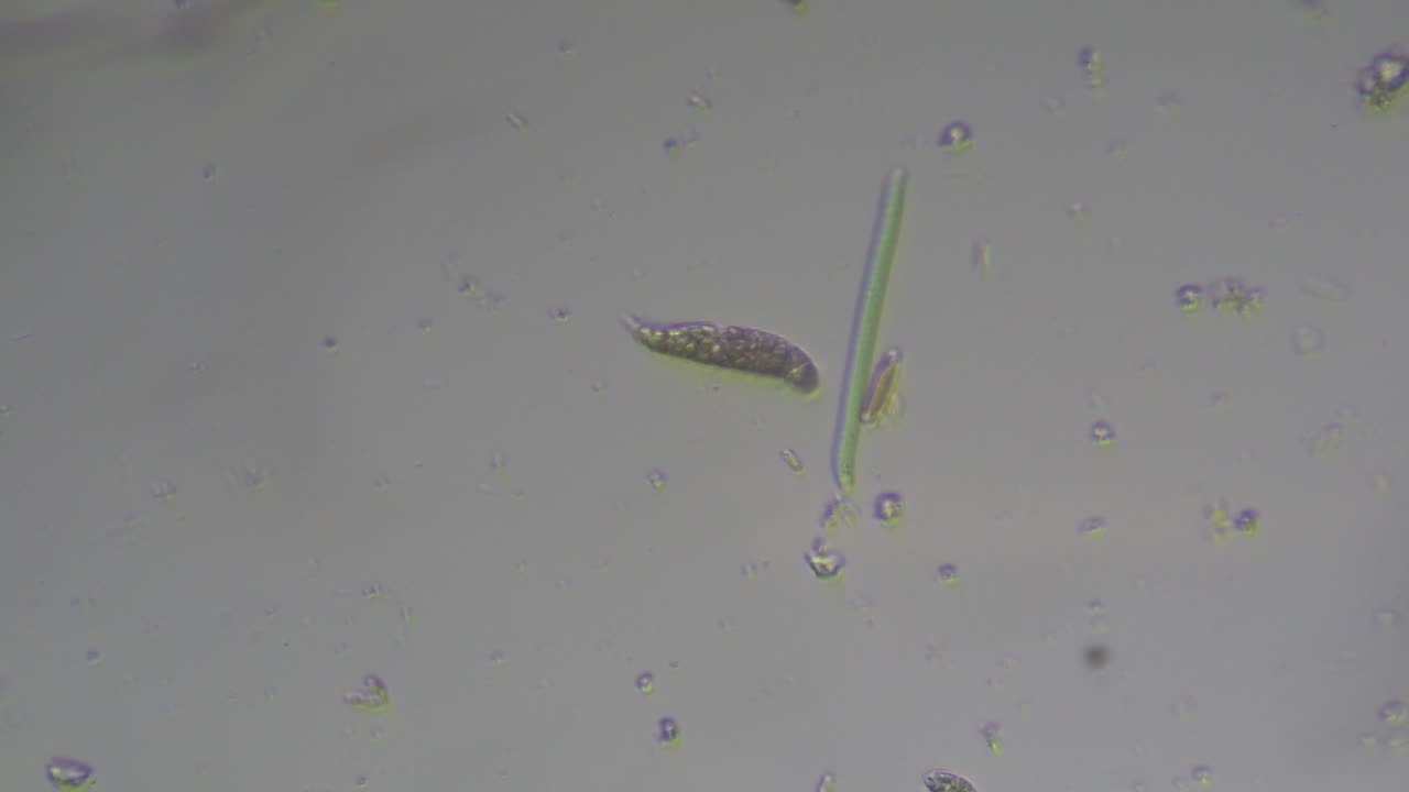 Amoeba from Outdoor Dirty Water