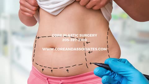 Liposuction in Birmingham, AL
