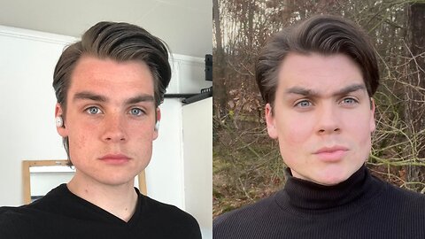 How I completely changed my face after 20 (no surgery)