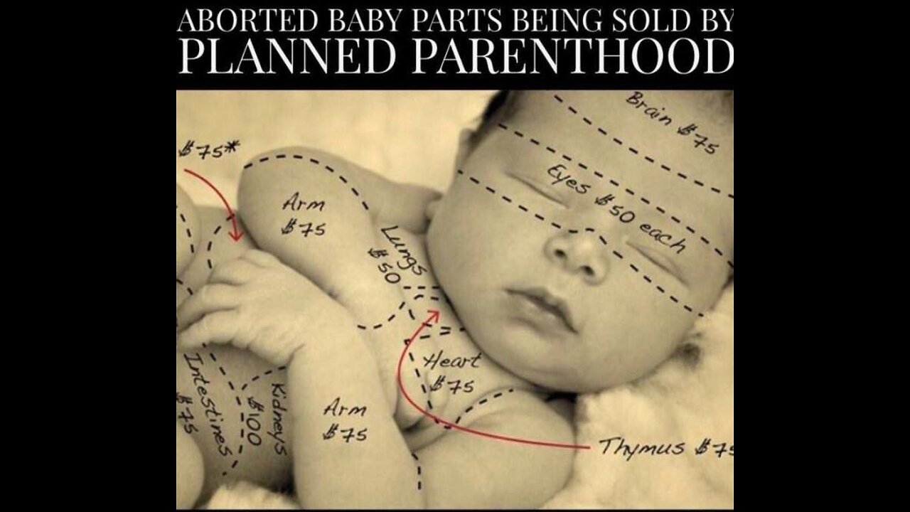 Planned Parenthood Selling: Intact Bodies, Lung Liver Kidney Thymus Tissue…