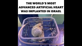 Israel implanted ARTIFICIAL HEART for the first time ever. Full heart transplant without human heart