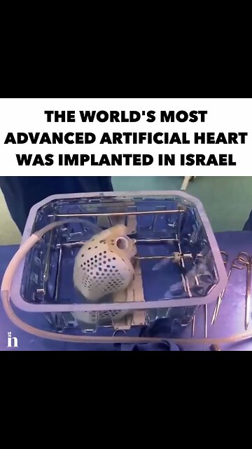 Israel implanted ARTIFICIAL HEART for the first time ever. Full heart transplant without human heart