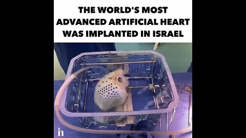 Israel implanted ARTIFICIAL HEART for the first time ever. Full heart transplant without human heart