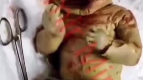 The Harlequin Baby Conspiracy A Hidden Lineage of Ancient Genetic Manipulation