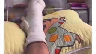 😂🐹 Hamster Mocks Owner's Foot Injury! | FunFM