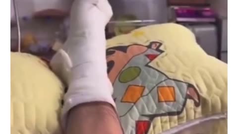 😂🐹 Hamster Mocks Owner's Foot Injury! | FunFM