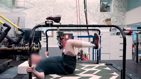 🤯✨ Bionic Knee Restores Leg Movement After Amputation! | FeedMyCuriosity