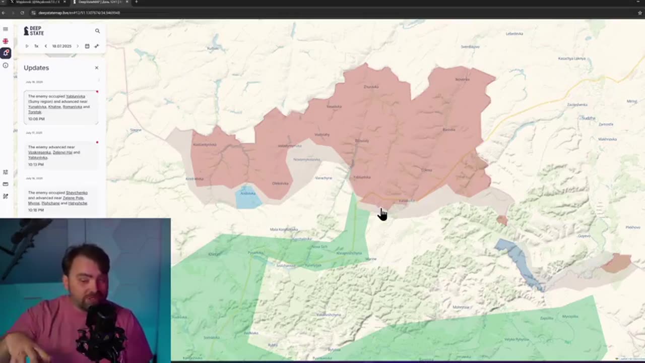 Advanced Russian Prosthetics - Discussing the Ukraine & Russian war