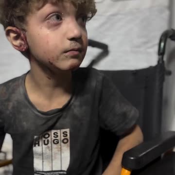 An injured child, signs of astonishment spread on his face, arrives at Al-Shifa Hospital