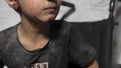An injured child, signs of astonishment spread on his face, arrives at Al-Shifa Hospital