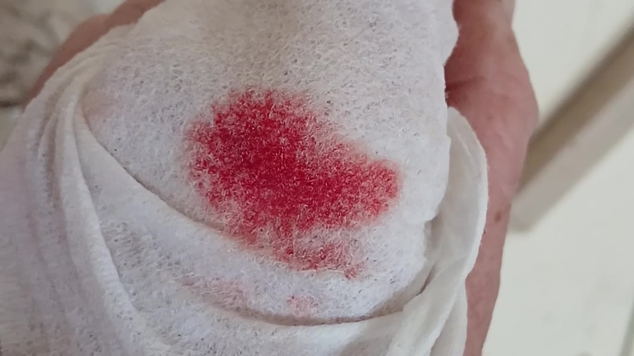 When lola died I cut myself & bled a luvheart