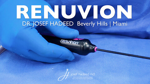 Renuvion Helium Plasma for Skin Tightening | Body Contouring & Liposuction