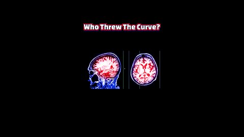Brain on the Brink: 5 Chilling Ways Your Mind Can Break