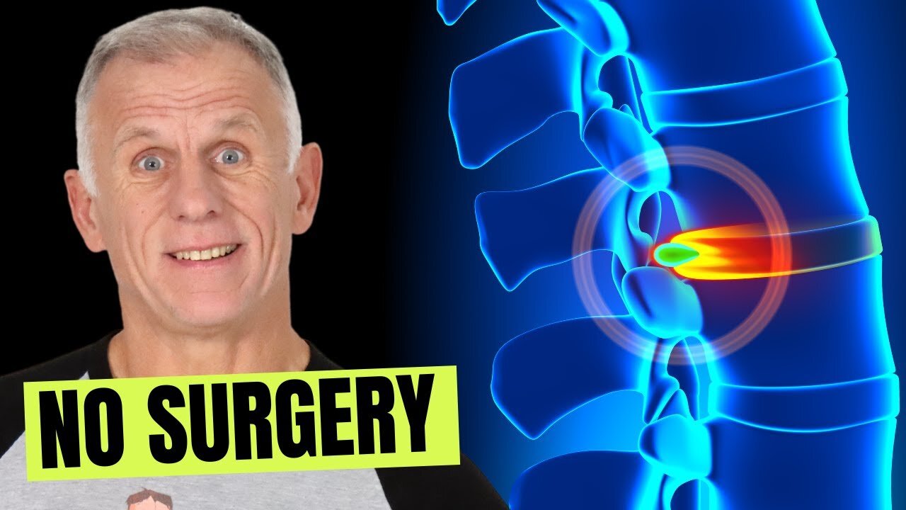 Shocking Trends in 1,400 Sciatica Cases