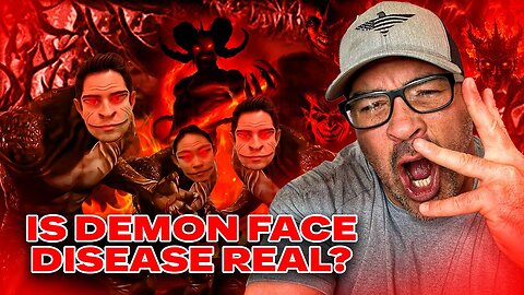 REAL?! Demon Face Syndrome Revealed..Shapeshifters Among Us? You Will Not Believe This.