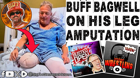 Buff Bagwell's Leg Amputated!