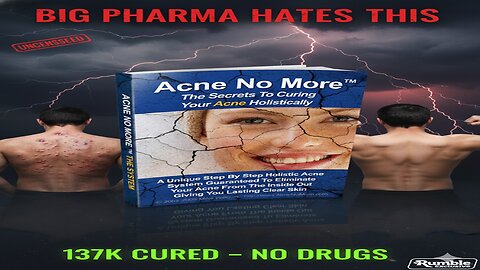 Acne No More by Mike Walden: 7-Layer Cure That Ended 137K Breakouts? Uncensored Review